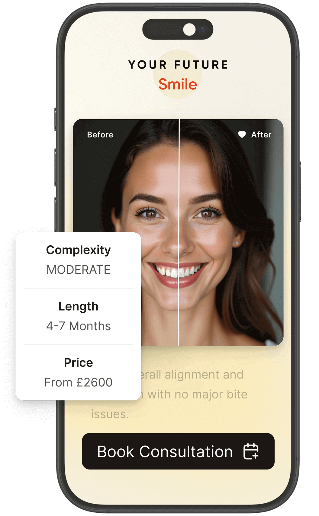 Before and after smile comparison
